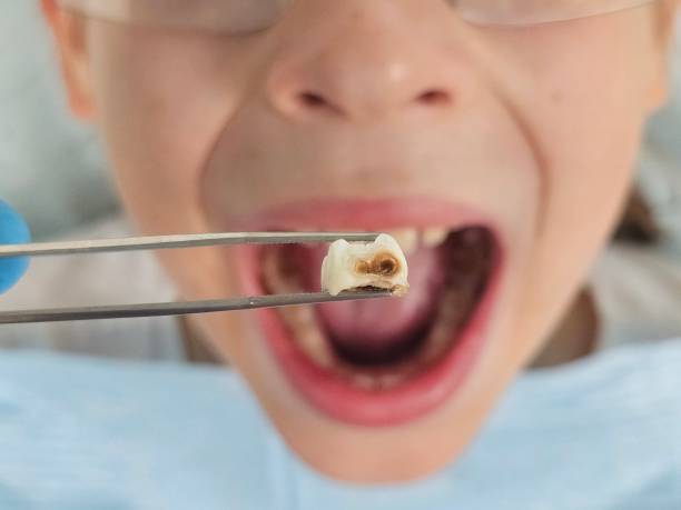 Best Same-Day Emergency Dentist in Nashville, GA